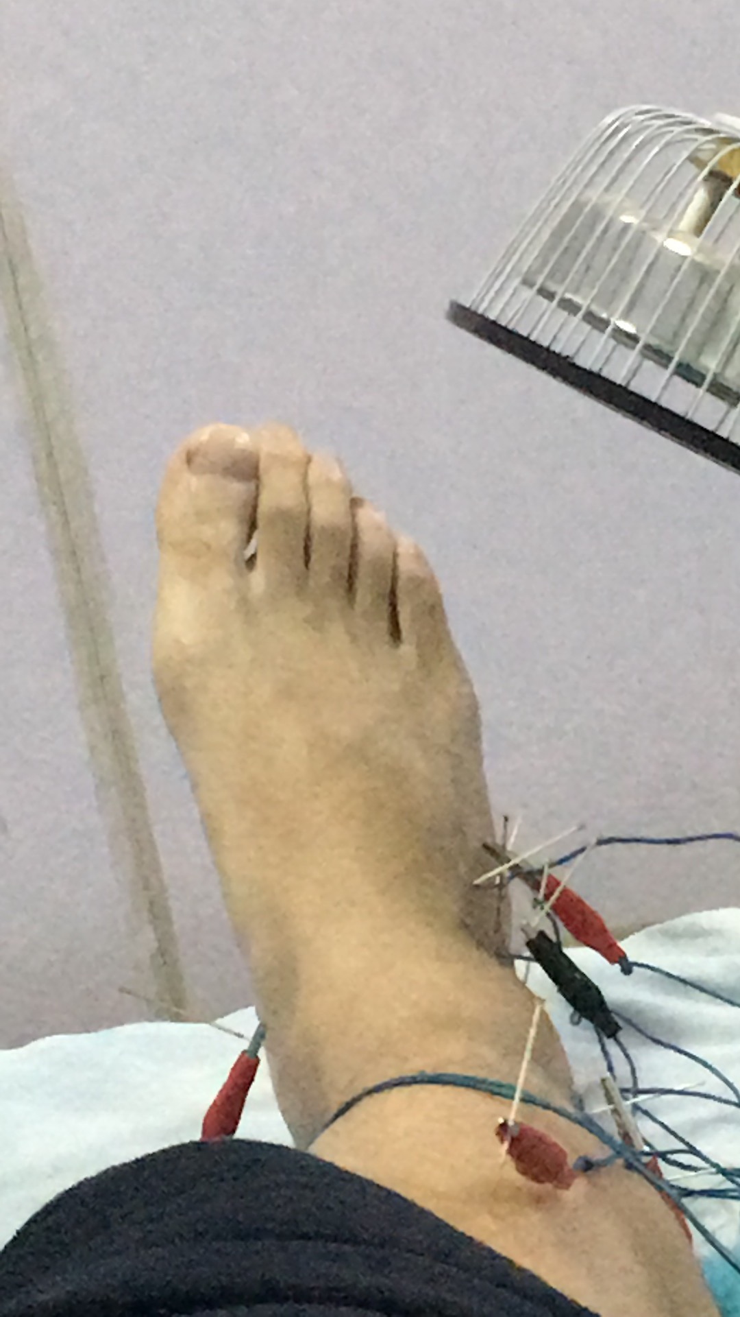 家中恢复,小马哥晒受伤的小腿