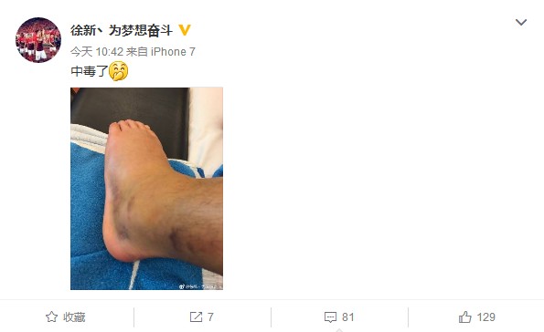 今天,广州恒大淘宝球员徐新在个人微博上晒出了自己受伤的脚部.